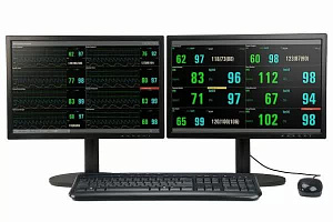 Монитор пациента Vista 120