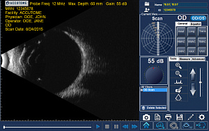 B-scan Plus